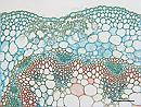 Chenopodium murale stem XS TRIARCH  20x