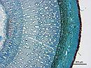 Rhamnus cathartica stem XS 4x